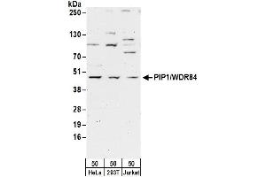 anti-PAK1 Interacting Protein 1 (PAK1IP1) (AA 290-340) antibody