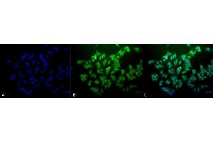 Immunocytochemistry/Immunofluorescence analysis using Mouse Anti-Ubiquitin Monoclonal Antibody, Clone 6C11-B3 (ABIN361817 and ABIN361816).