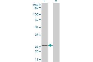 Western Blotting (WB) image for anti-Thiamine Triphosphatase (THTPA) (AA 1-230) antibody (ABIN528923)