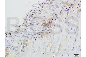 Formalin-fixed and paraffin embedded rat colitis labeled with Anti-CD28 Polyclonal Antibody, Unconjugated (ABIN674604) at 1:200 followed by conjugation to the secondary antibody and DAB staining. (CD28 Antikörper  (AA 1-120))