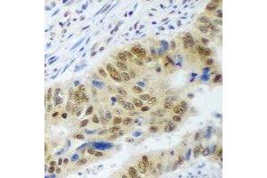 Immunohistochemical analysis of WDR48 staining in human colon formalin fixed paraffin embedded tissue section. (WDR48 Antikörper)