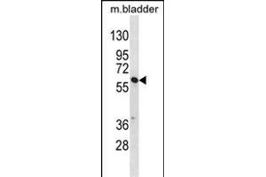 SNX30 Antibody (C-term) (ABIN1537180 and ABIN2849996) western blot analysis in mouse bladder tissue lysates (35 μg/lane). (SNX30 Antikörper  (C-Term))