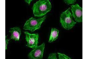 Immunofluorescence (IF) image for anti-Antigen Identified By Monoclonal Antibody Ki-67 (MKI67) antibody (Alexa Fluor 647) (ABIN2657968)