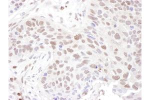 Immunohistochemistry (IHC) image for anti-Zinc Finger Protein 462 (ZNF462) (AA 2456-2506) antibody (ABIN7453414)