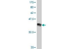 Western Blotting (WB) image for anti-Protein Kinase, CGMP-Dependent, Type II (PRKG2) (AA 1-100) antibody (ABIN562403)