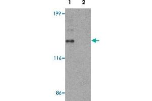 Western blot analysis of HeLa cell lysate with ZNF521 polyclonal antibody  at 1 ug/mL in (1) the absence and (2) the presence of blocking peptide. (ZNF521 Antikörper  (N-Term))