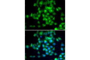 Immunofluorescence analysis of MCF-7 cells using SIRT3 antibody (ABIN5974409). (SIRT3 Antikörper)