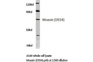 Western blot (WB) analysis of Moesin antibody in extracts from A549 cells. (Moesin Antikörper)