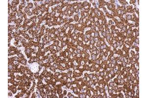 Immunohistochemistry (IHC) image for anti-Lysophosphatidic Acid Receptor 3 (LPAR3) antibody (ABIN2857017)