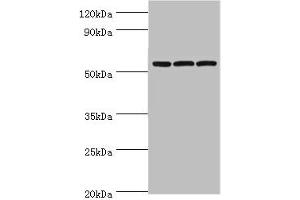 Western blot All lanes: Alpha-amylase 2B antibody at 8 μg/mL Lane 1: Mouse skeletal muscle tissue Lane 2: HL60 whole cell lysate Lane 3: K562 whole cell lysate Secondary Goat polyclonal to rabbit IgG at 1/10000 dilution Predicted band size: 58, 43 kDa Observed band size: 58 kDa (AMY2B Antikörper  (AA 16-320))