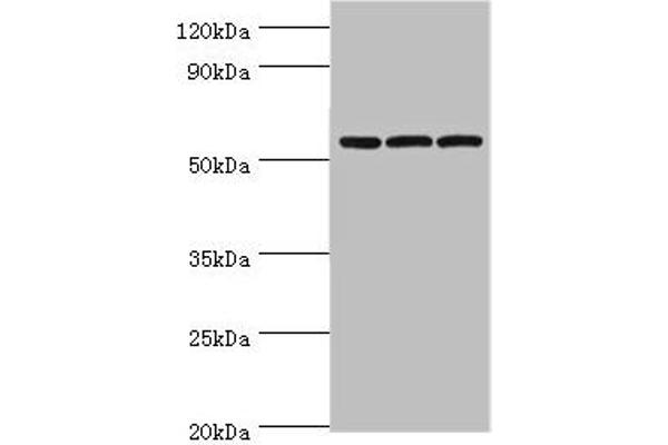 AMY2B Antikörper  (AA 16-320)