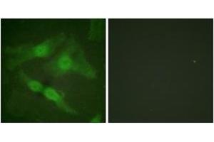 Immunofluorescence analysis of HeLa cells, using PKC zeta (Phospho-Thr410) Antibody. (PKC zeta Antikörper  (pThr410))