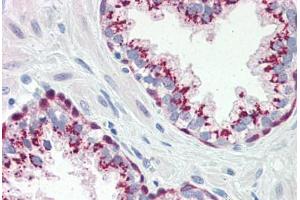 Human Prostate (formalin-fixed, paraffin-embedded) stained with Heat Shock Protein 70 (HSP70) antibody ABIN364327 at 10 ug/ml followed by biotinylated anti-mouse IgG secondary antibody ABIN481714, alkaline phosphatase-streptavidin and chromogen. (HSP70 Antikörper  (AA 1-641))