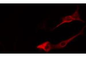 ABIN6274816 staining LOVO cells by IF/ICC. (ARF4 Antikörper  (Internal Region))