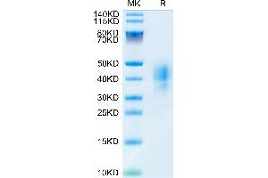 SDS-PAGE (SDS) image for CD47 (CD47) (AA 19-140) protein (His tag) (ABIN7274237)