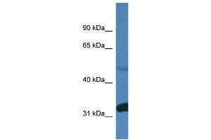 WB Suggested Anti-Ppp2r2d Antibody Titration: 1. (PPP2R2D Antikörper  (C-Term))