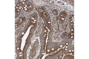 Immunohistochemical staining of human duodenum with KY polyclonal antibody  shows strong cytoplasmic positivity in glandular cells.