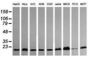 Image no. 1 for anti-HRas proto-oncogene, GTPase (HRAS) antibody (ABIN1498715) (HRAS Antikörper)