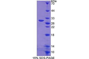 Image no. 1 for Nitric Oxide Synthase 2, Inducible (NOS2) (AA 734-966) protein (His tag) (ABIN6239953) (NOS2 Protein (AA 734-966) (His tag))