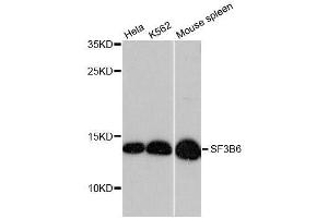 Western blot analysis of extracts of various cell lines, using SF3B6 antibody. (Pre-mRNA Branch Site Protein p14 (SF3B14) (AA 1-125) Antikörper)