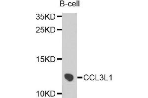 Western blot analysis of extracts of B cells, using CCL3L1 antibody.