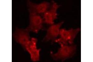 ABIN6266964 staining Hela by IF/ICC. (TPD52L2 Antikörper  (C-Term))