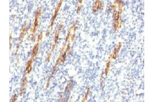Formalin-fixed, paraffin-embedded human tonsil stained with CD34 antibody (QBEnd/10 + HPCA1/763) (CD34 Antikörper)