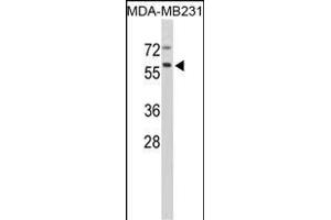 Western blot analysis of CTSF Antibody (Center ) (ABIN390488 and ABIN2840848) in MDA-M cell line lysates (35 μg/lane). (Cathepsin F Antikörper  (AA 261-290))