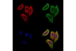 ABIN6265207 and ABIN6277244 staining Hela cells by IF/ICC. (SNCG Antikörper  (C-Term))