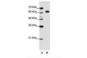 Image no. 2 for anti-DIS3-Like Exonuclease 2 (DIS3L2) (AA 121-170) antibody (ABIN202821) (DIS3L2 Antikörper  (AA 121-170))