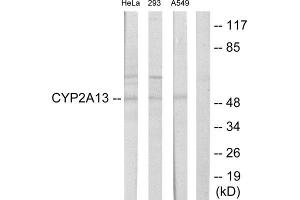 Western Blotting (WB) image for anti-Cytochrome P450, Family 2, Subfamily A, Polypeptide 13 (CYP2A13) (Internal Region) antibody (ABIN1850348) (CYP2A13 Antikörper  (Internal Region))