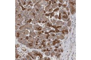 Immunohistochemical staining of human pancreas with SMAP2 polyclonal antibody  shows strong cytoplasmic positivity in pancreatic ducts. (SMAP2 Antikörper)