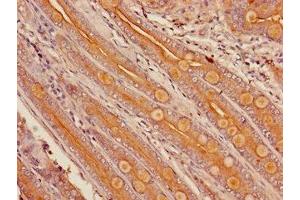 Immunohistochemistry of paraffin-embedded human small intestine tissue using ABIN7149259 at dilution of 1:100 (CYP3A4 Antikörper  (AA 259-441))