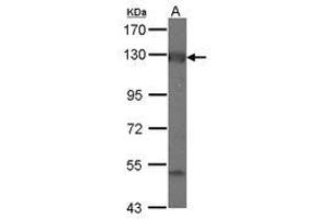 Image no. 1 for anti-Adenylate Cyclase 2 (Brain) (ADCY2) (C-Term) antibody (ABIN1491734) (ADCY2 Antikörper  (C-Term))