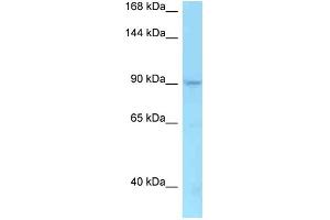 WB Suggested Anti-TMEM63A Antibody   Titration: 1. (TMEM63A Antikörper  (C-Term))