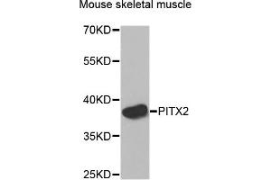 Western blot analysis of extracts of Mouse skeletal muscle cells, using PITX2 antibody. (PITX2 Antikörper)