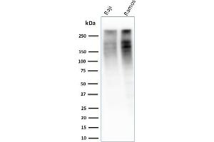 Western Blot Analysis of Raji and Ramos cell lysate using Ki67 Mouse Monoclonal Antibody (MKI67/2461). (Ki-67 Antikörper  (AA 2293-2478))