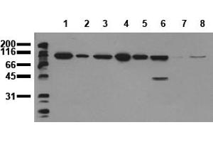 Western Blotting (WB) image for anti-Catenin (Cadherin-Associated Protein), beta 1, 88kDa (CTNNB1) (Exon 3) antibody (ABIN126747)