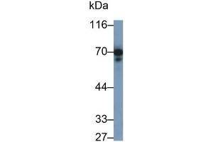 Detection of PTPRO in Rat Cerebrum lysate using Polyclonal Antibody to Protein Tyrosine Phosphatase Receptor Type O (PTPRO) (PTPRO Antikörper  (AA 948-1205))