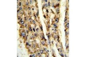 Immunohistochemistry (Paraffin-embedded Sections) (IHC (p)) image for anti-Deiodinase, Iodothyronine, Type III (DIO3) (AA 249-278), (C-Term) antibody (ABIN951914)