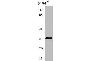 Western Blot analysis of HT29 cells using Olfactory receptor 2J2 Polyclonal Antibody (OR2J2 Antikörper  (C-Term))
