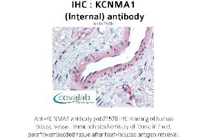 Image no. 1 for anti-Potassium Large Conductance Calcium-Activated Channel, Subfamily M, alpha Member 1 (KCNMA1) (Internal Region) antibody (ABIN1736190) (KCNMA1 Antikörper  (Internal Region))