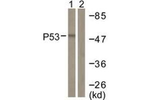 Western blot analysis of extracts from COS7 cells, treated with TSA 400nM 24h, using p53 (Ab-382) Antibody. (p53 Antikörper  (AA 344-393))