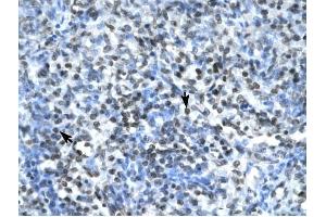 Claudin 17 antibody was used for immunohistochemistry at a concentration of 4-8 ug/ml to stain Spleen cells (arrows) in Human Spleen. (Claudin 17 Antikörper  (Middle Region))