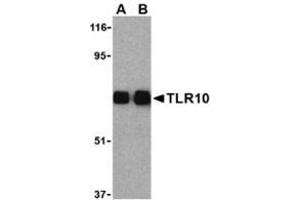 Western blot analysis of TLR10 in human lymph node cell lysates with this product at (A) 0. (TLR10 Antikörper  (Center))