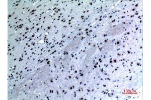 Immunohistochemistry (IHC) analysis of paraffin-embedded Rat Brain, antibody was diluted at 1:100. (KRT14 Antikörper  (C-Term))