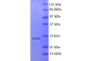 SDS-PAGE (SDS) image for Hepatitis A Virus Cellular Receptor 2 (TIM 3) (AA 22-202), (Extracellular) protein (His tag) (ABIN5709645) (TIM3 Protein (AA 22-202, Extracellular) (His tag))