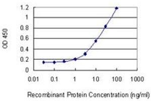 Detection limit for recombinant GST tagged PRKCDBP is 0. (PRKCDBP Antikörper  (AA 161-261))