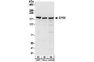 anti-Glutamyl-Prolyl-tRNA Synthetase (EPRS) (AA 275-325) antibody