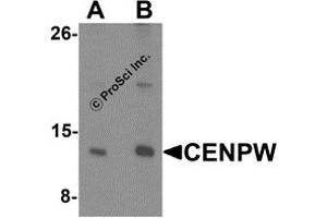 Western Blotting (WB) image for anti-Centromere Protein W (CENPW) (N-Term) antibody (ABIN1587944) (CENPW Antikörper  (N-Term))